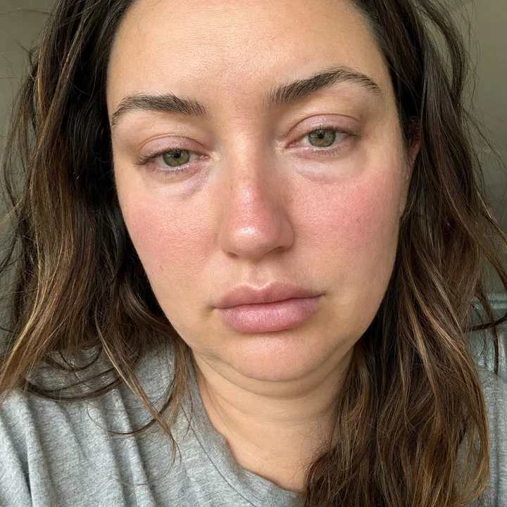ultra close-up of maya, no makeup, peak cortisol-face puffiness